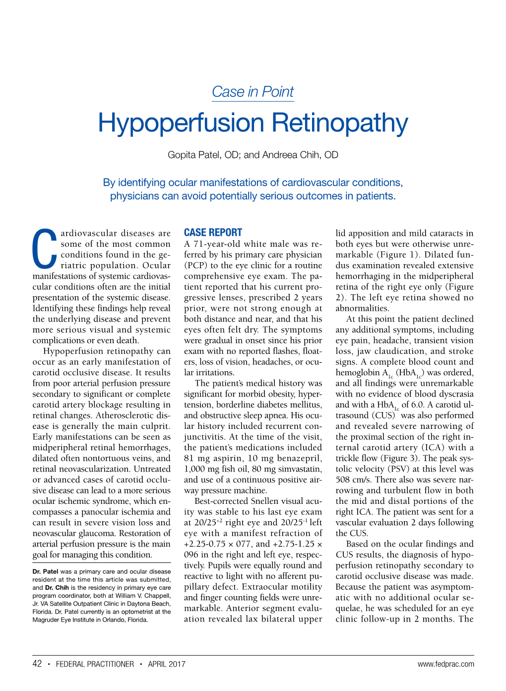 Hypoperfusion Retinopathy