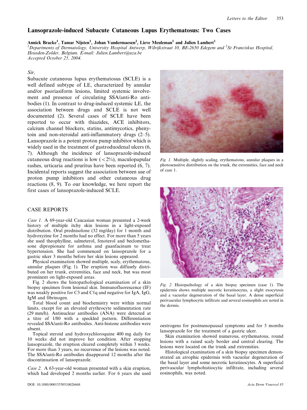 Lansoprazole-Induced Subacute Cutaneous Lupus Erythematosus: Two Cases
