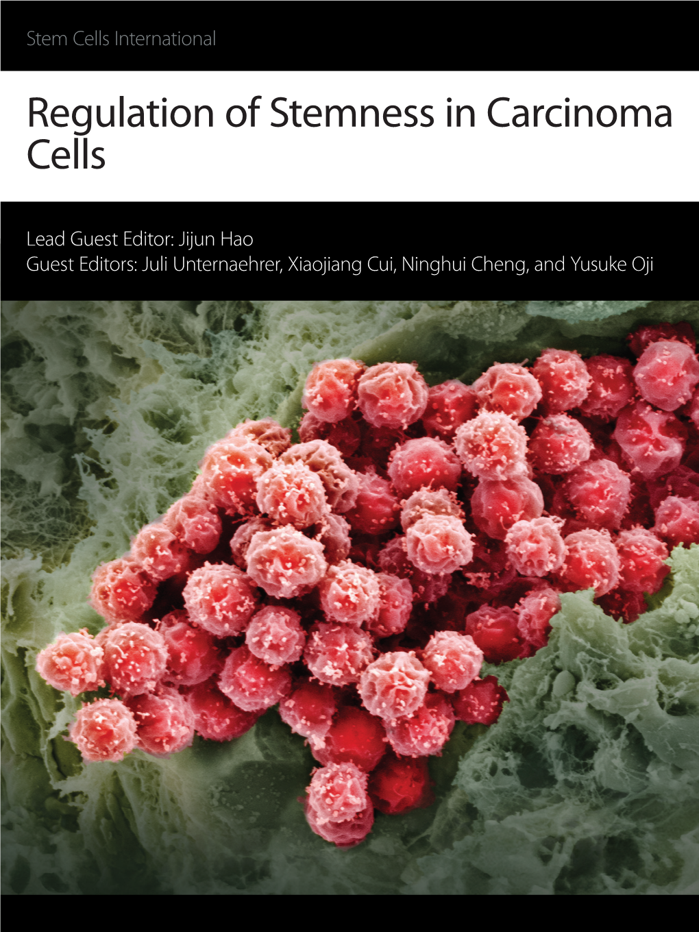 Regulation of Stemness in Carcinoma Cells