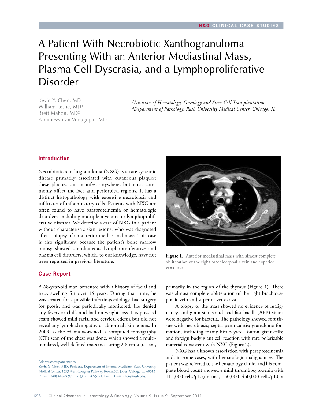 A Patient with Necrobiotic Xanthogranuloma Presenting with an Anterior Mediastinal Mass, Plasma Cell Dyscrasia, and a Lymphoproliferative Disorder