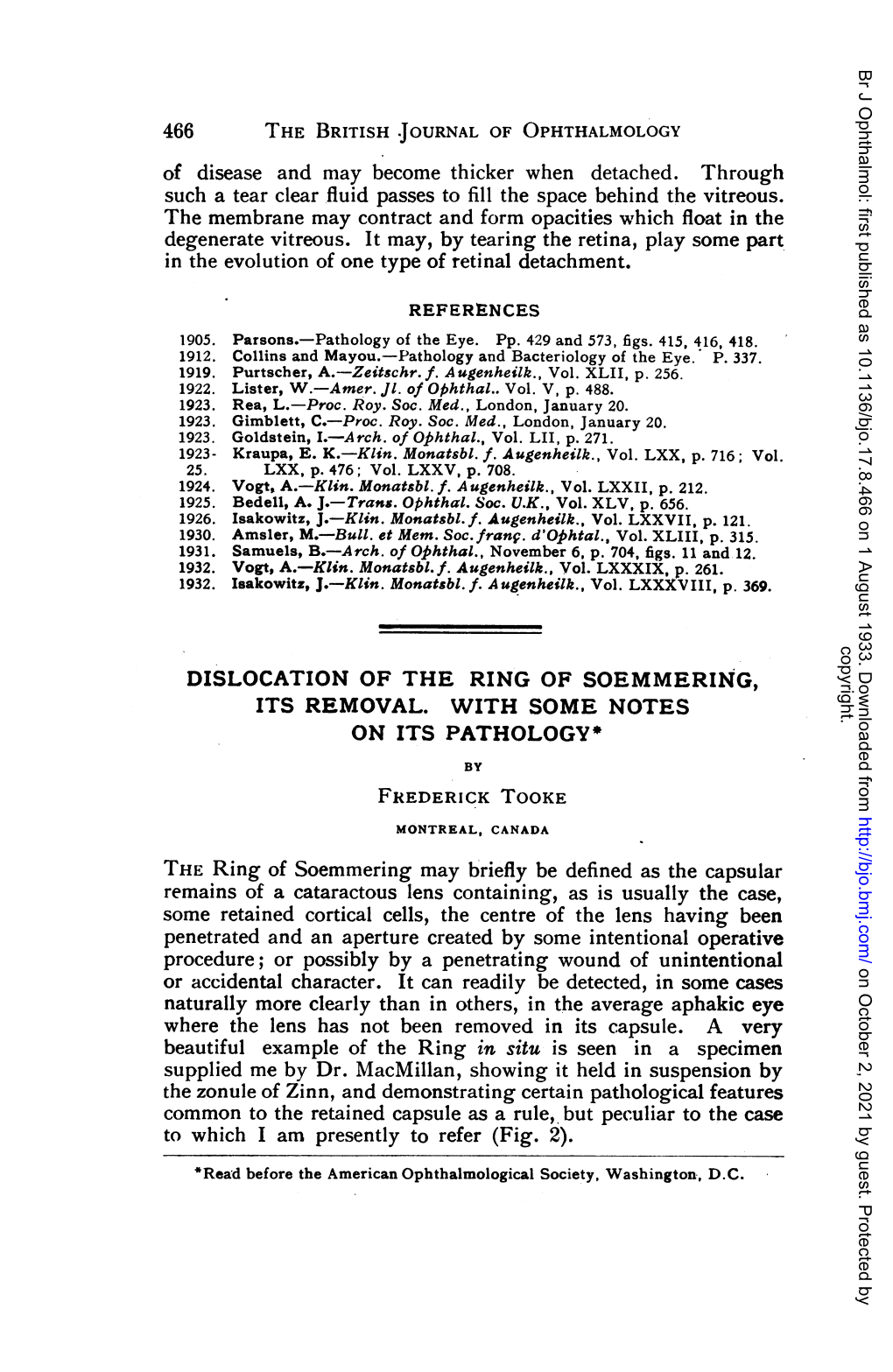 The Zonule of Zinn, and Demonstrating Certain Pathological Features