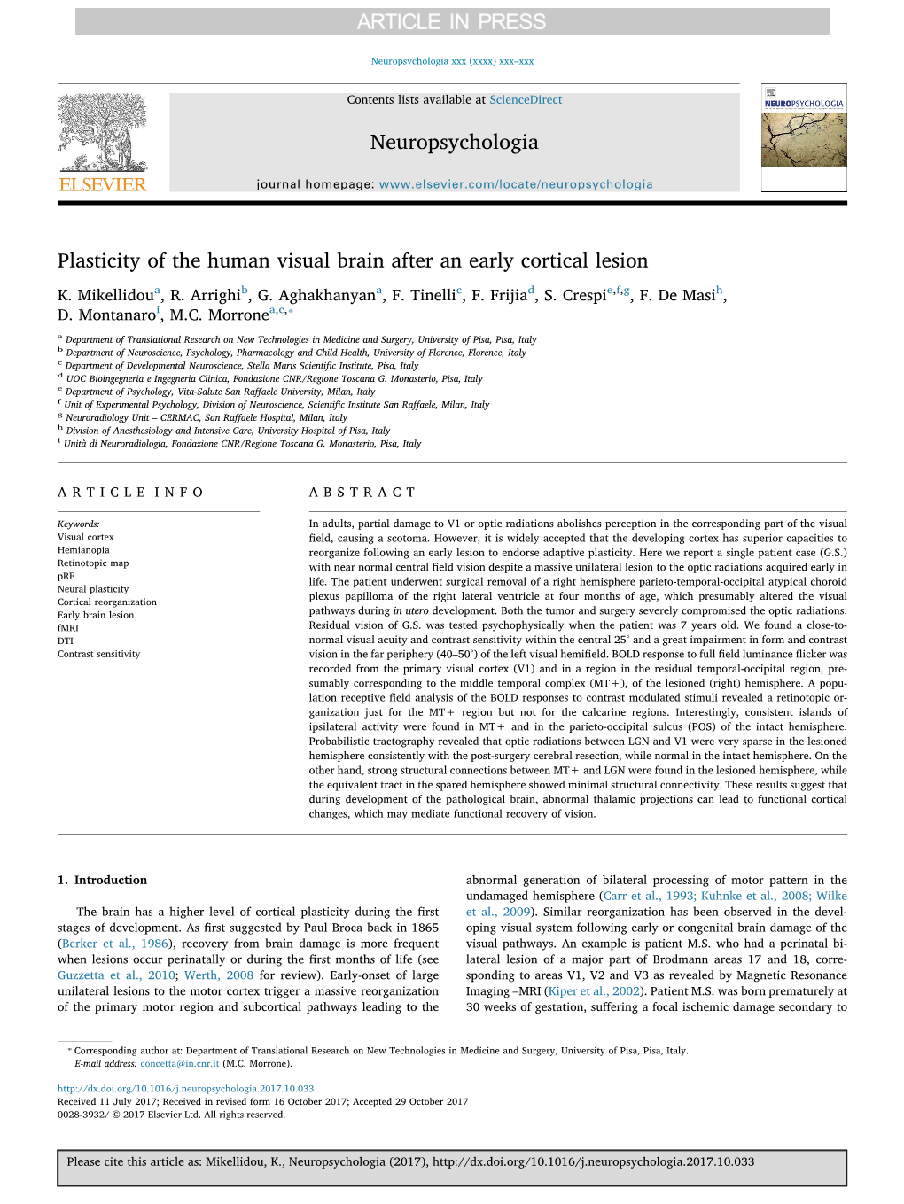 Plasticity of the Human Visual Brain After an Early Cortical Lesion