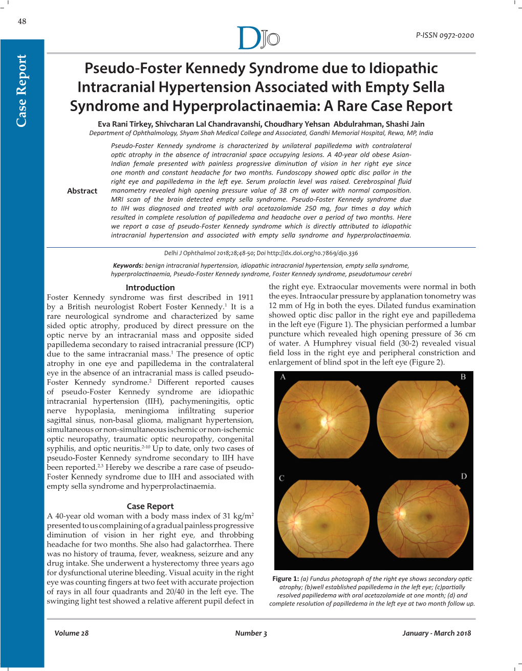 Pseudo-Foster Kennedy Syndrome Due to Idiopathic Intracranial Hypertension Associated with Empty Sella Syndrome and Hyperprolactinaemia: a Rare Case Report