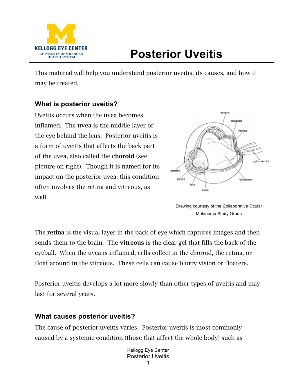 Posterior Uveitis