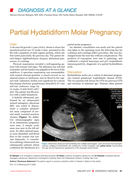 Partial Hydatidiform Molar Pregnancy