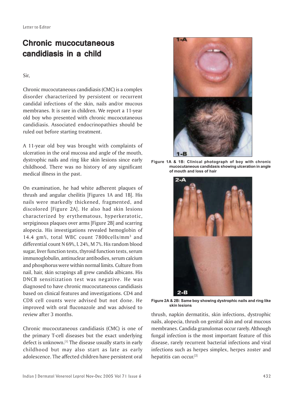 Chronic Mucocutaneous Candidiasis in a Child