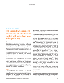 Two Cases of Lymphangioma Circumscriptum Successfully Treated