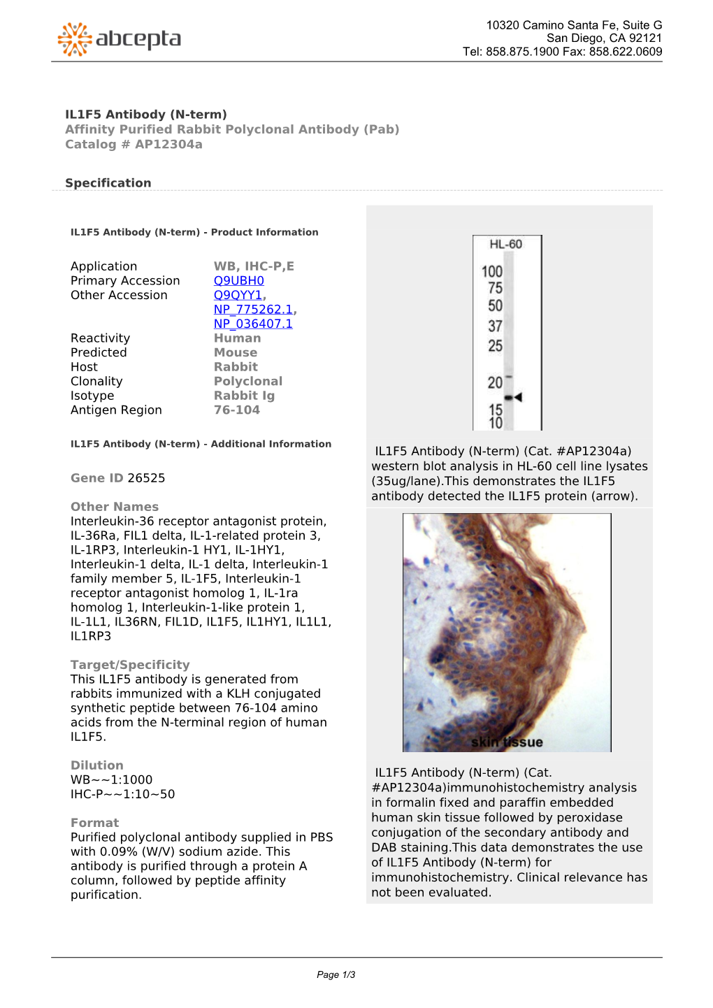 IL1F5 Antibody (N-Term) Affinity Purified Rabbit Polyclonal Antibody (Pab) Catalog # Ap12304a