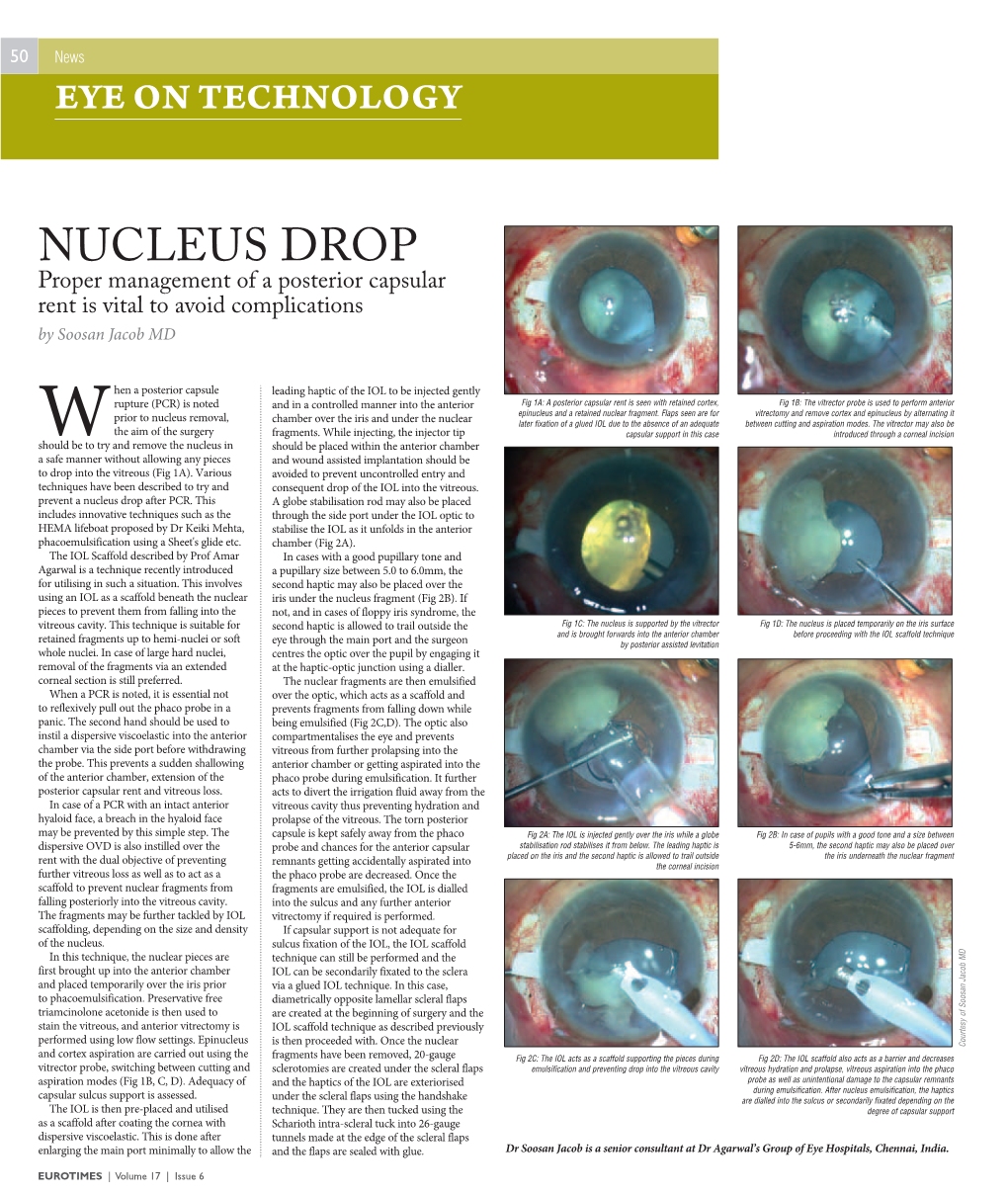 Nucleus Drop After PCR