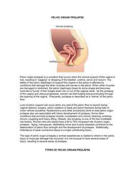 Pelvic Organ Prolapse