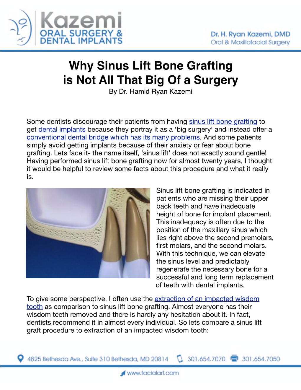 Why Sinus Lift Bone Grafting Is Not All That Big of a Surgery by Dr