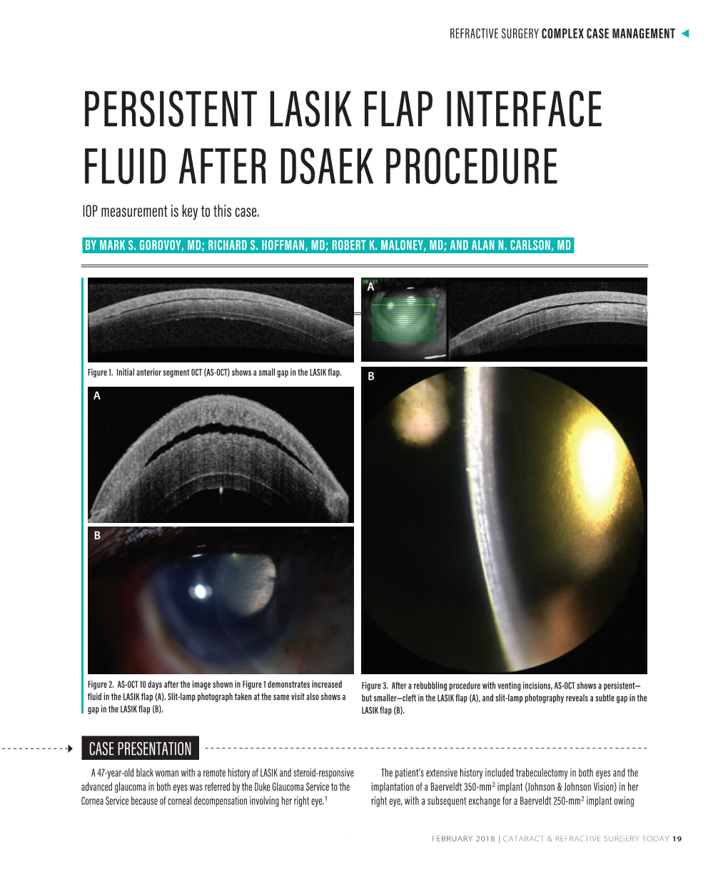 Headline Persistent Lasik Flap Interface Fluid After