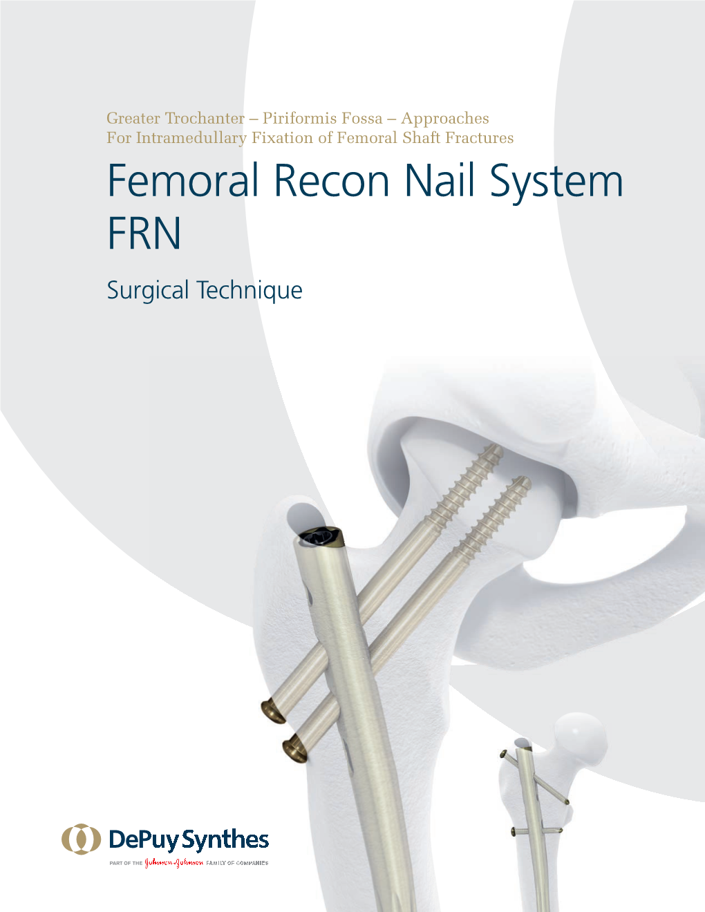 Femoral Recon Nail System FRN Surgical Technique