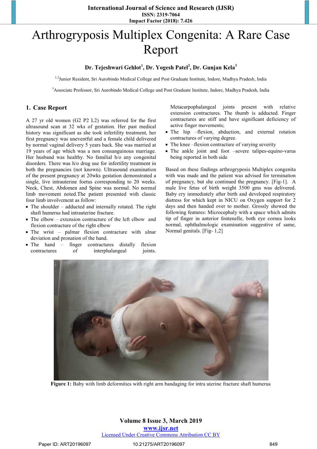 Arthrogryposis Multiplex Congenita: a Rare Case Report