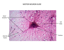 Motor Neuron Slide
