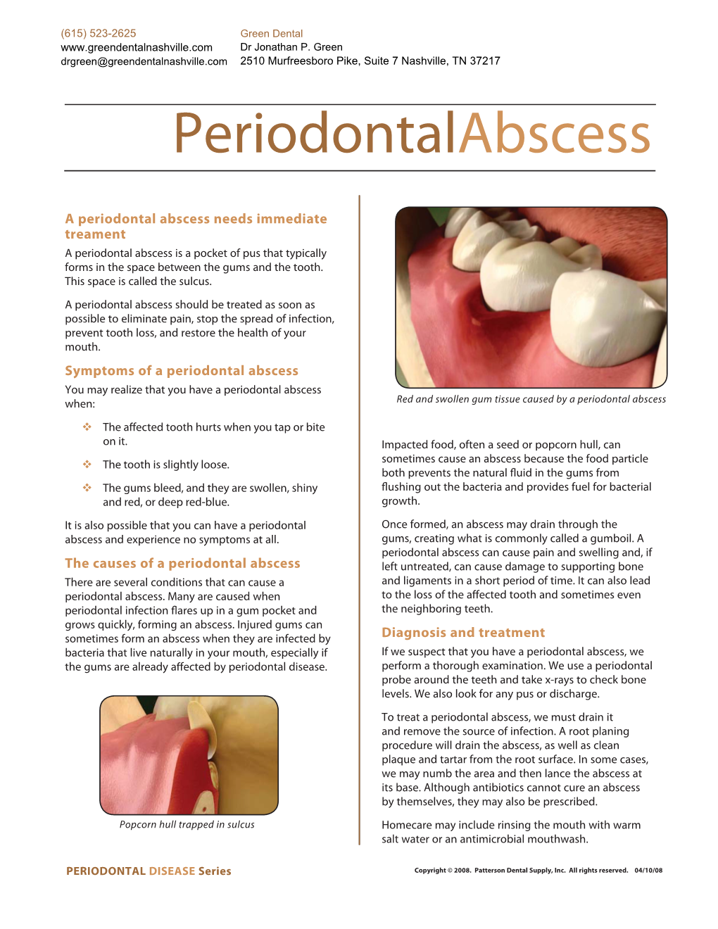 What Is a Periodontal Abscess.Pdf