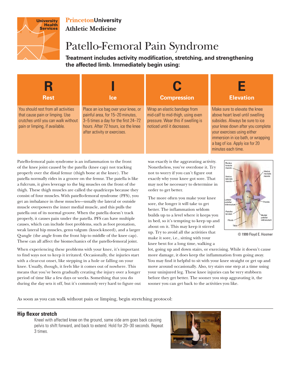 Patello-Femoral Pain Syndrome Treatment Includes Activity Modification, Stretching, and Strengthening the Affected Limb