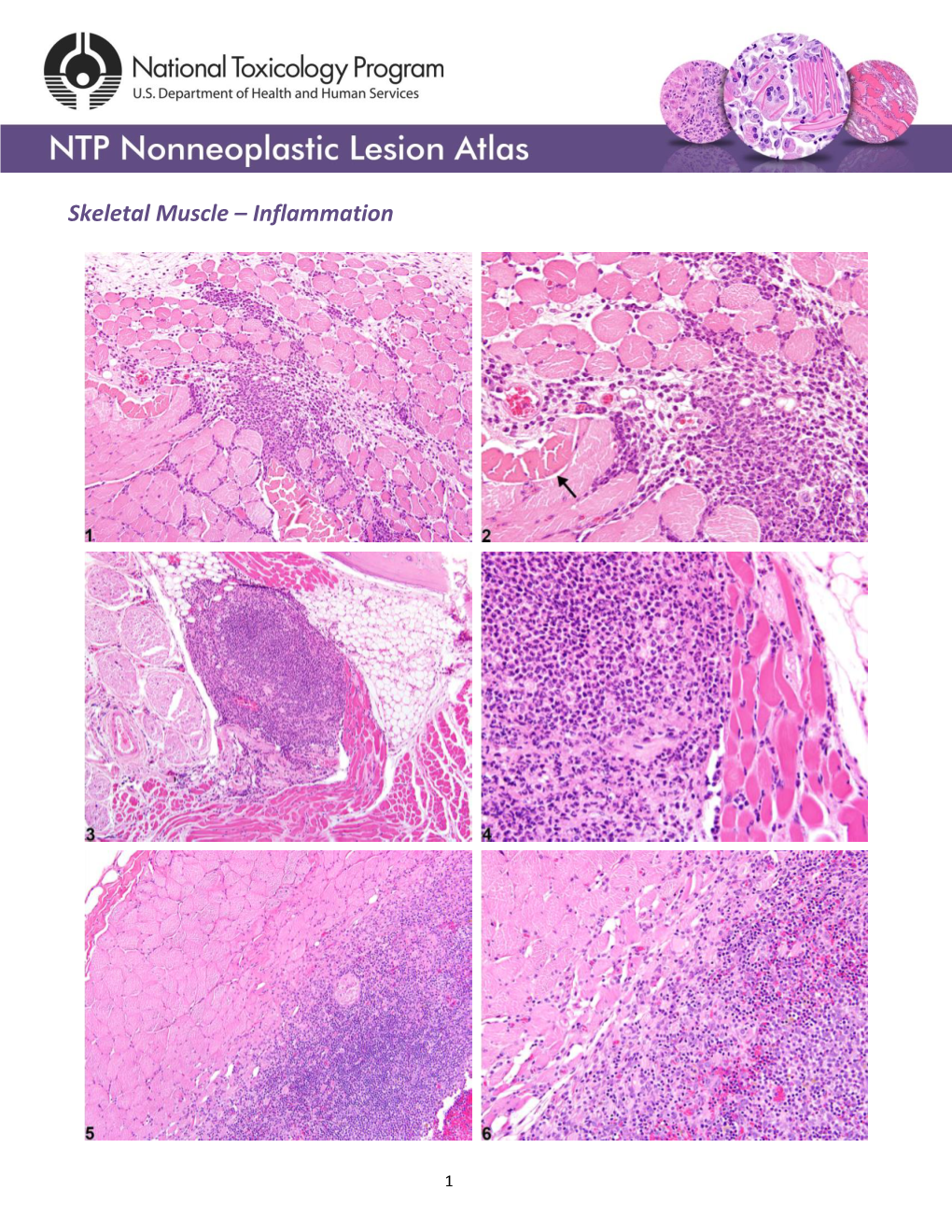 Skeletal Muscle – Inflammation