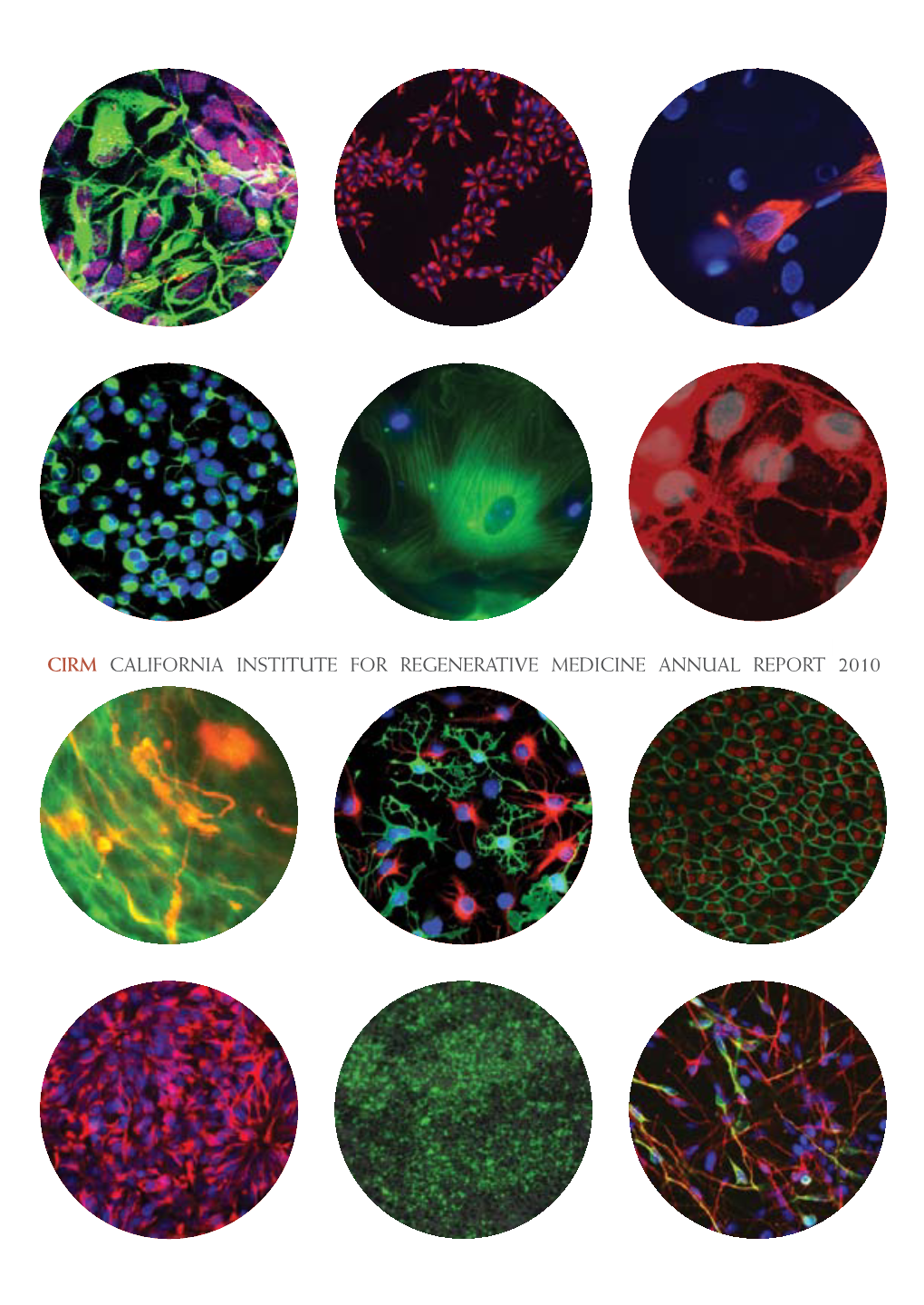 CIRM California Institute for Regenerative Medicine Annual Report 2010 Autoimmune Diseases Arthritis Crohn’S