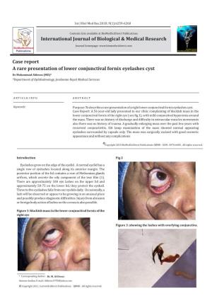 A Rare Presentation of Lower Conjunctival Fornix Eyelashes Cyst Dr Mohammad Aldroos (MD)* *Department of Ophthalmology, Jordanian Royal Medical Services