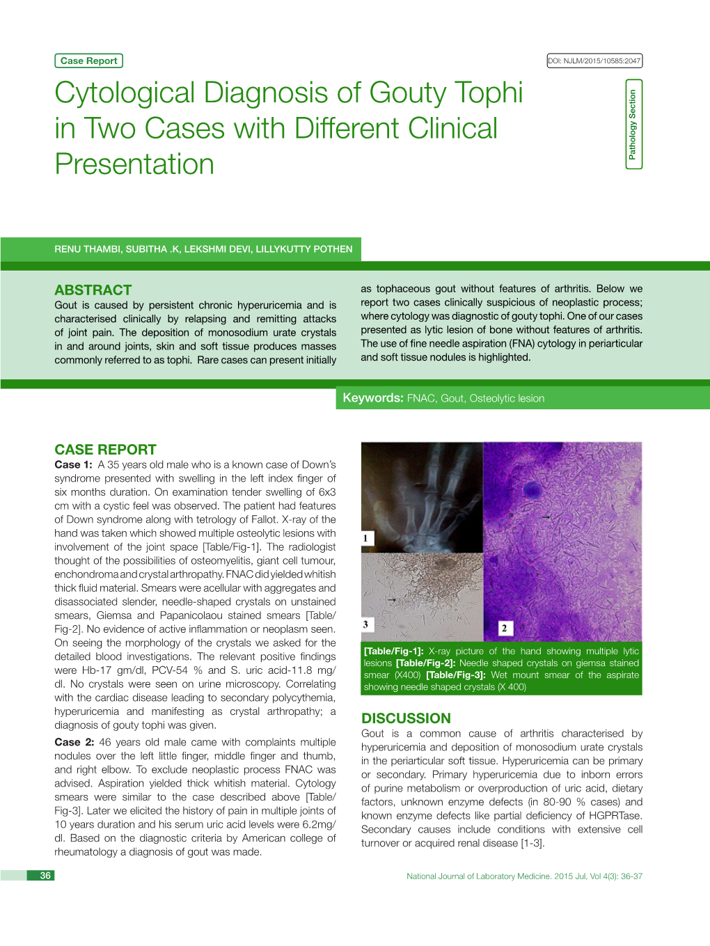 Cytological Diagnosis of Gouty Tophi in Two Cases with Different Clinical Presentation Pathology Section