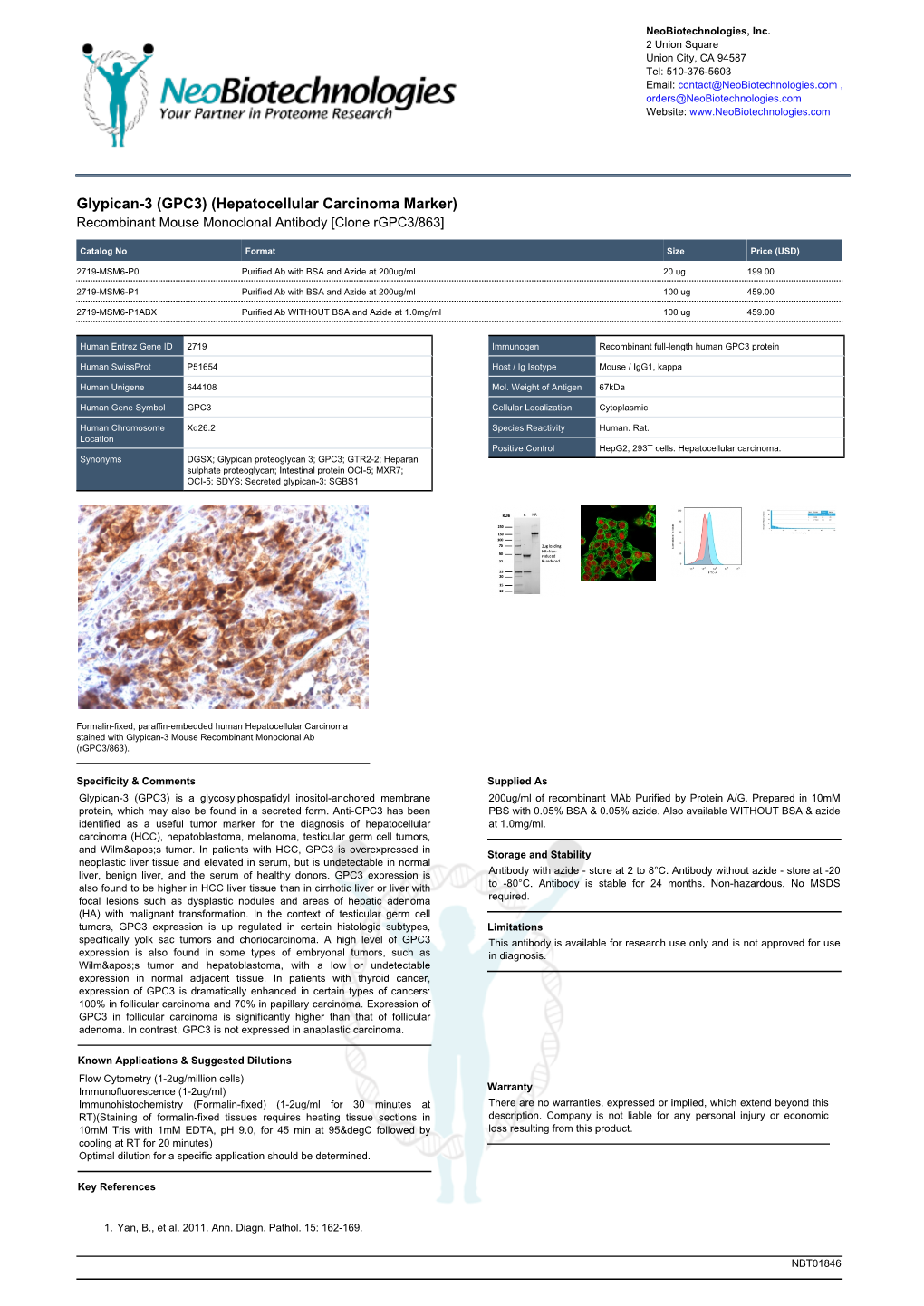 (GPC3) (Hepatocellular Carcinoma Marker) Recombinant Mouse Monoclonal Antibody [Clone Rgpc3/863]