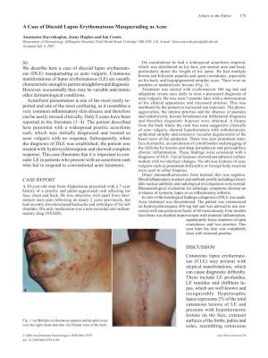 A Case of Discoid Lupus Erythematosus Masquerading As Acne