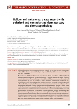 Balloon Cell Melanoma: a Case Report with Polarized and Non-Polarized Dermatoscopy and Dermatopathology. Dermatol Pract Concept. 2014; 4 (1): 11