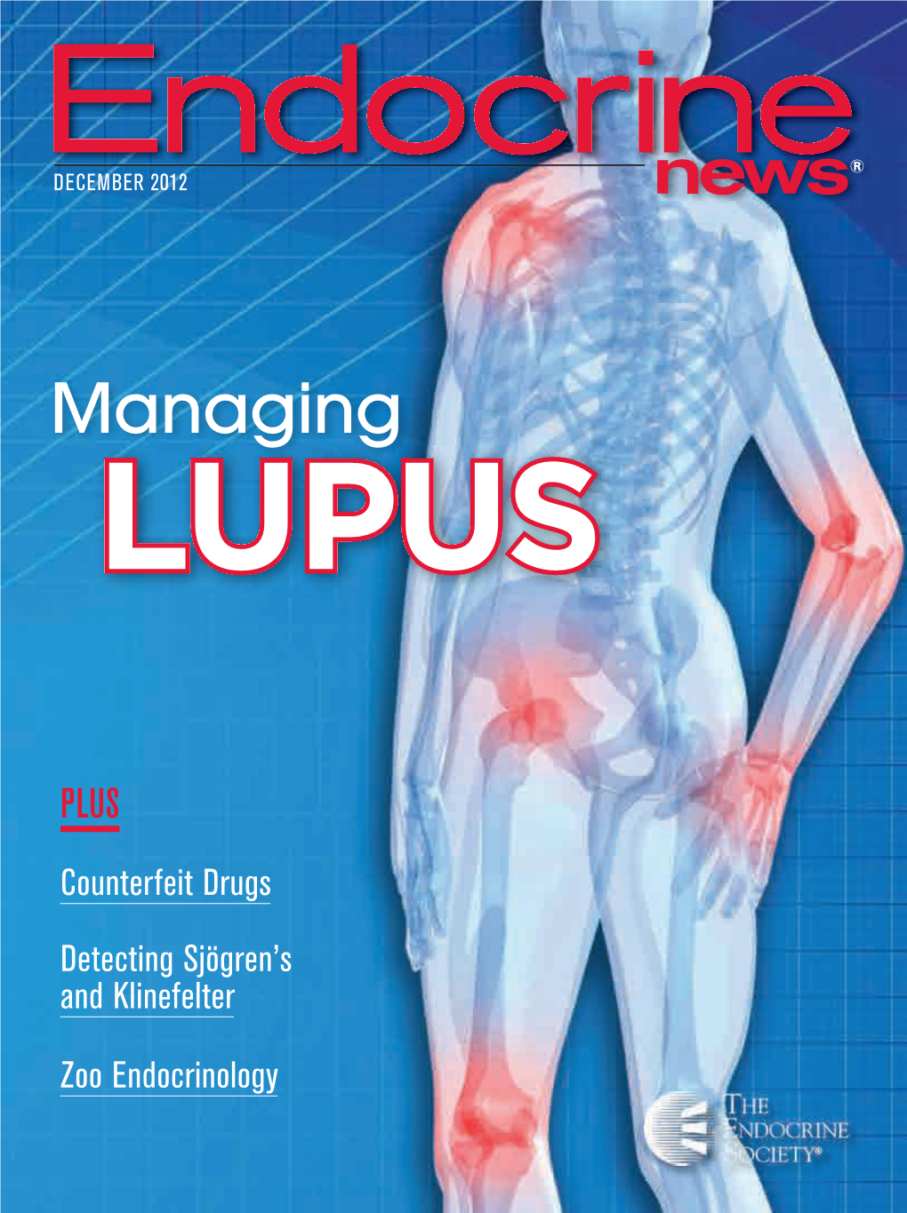 Managingsex LUPUS