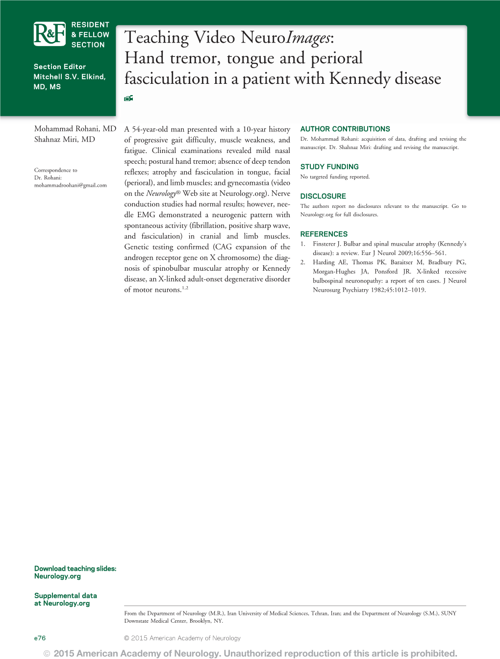 Hand Tremor, Tongue and Perioral Fasciculation in A