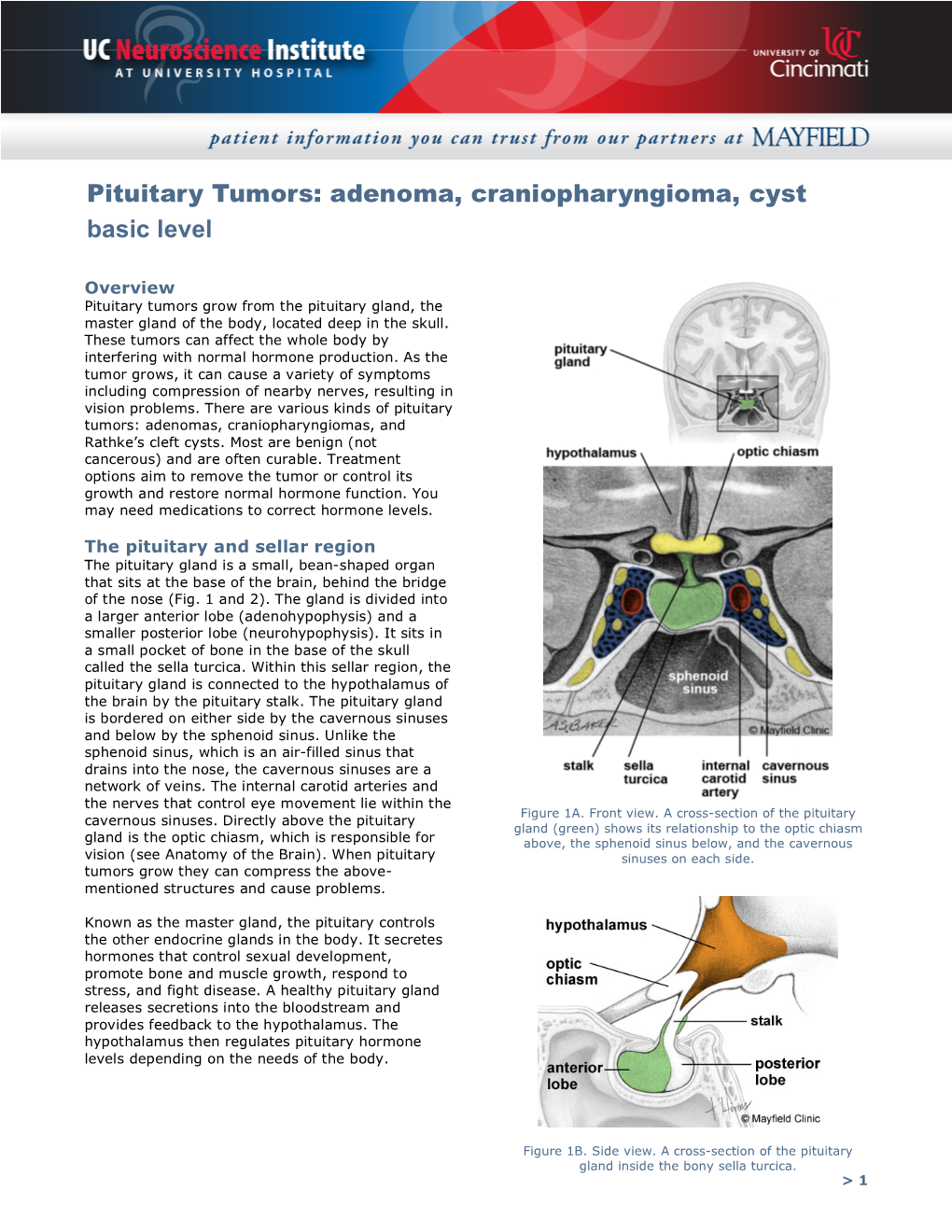 Pituitary Tumors: Adenoma, Craniopharyngioma, Cyst