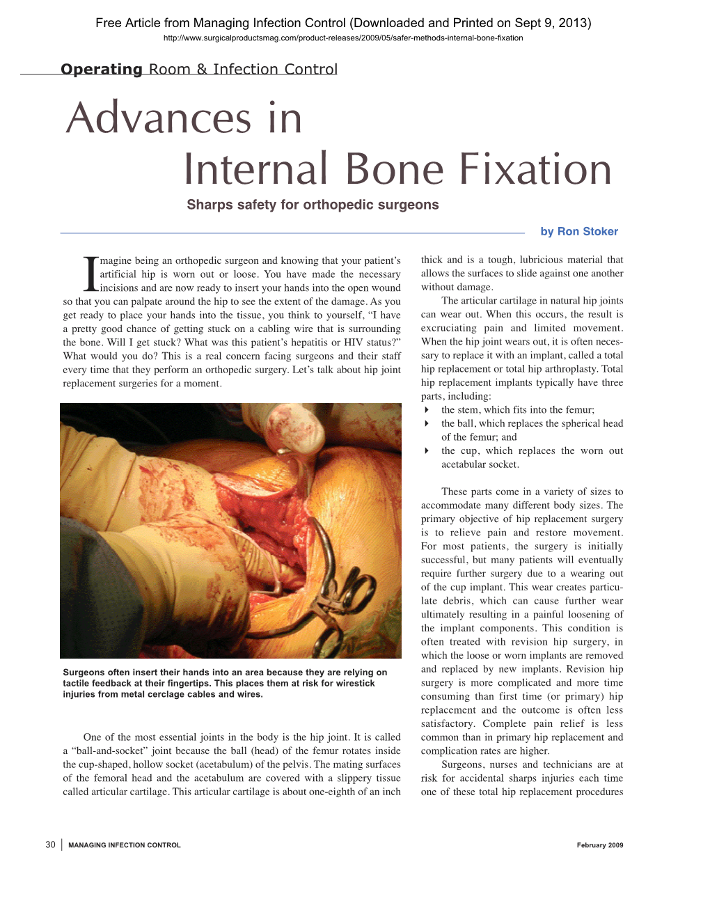 Internal Bone Fixation Advances In