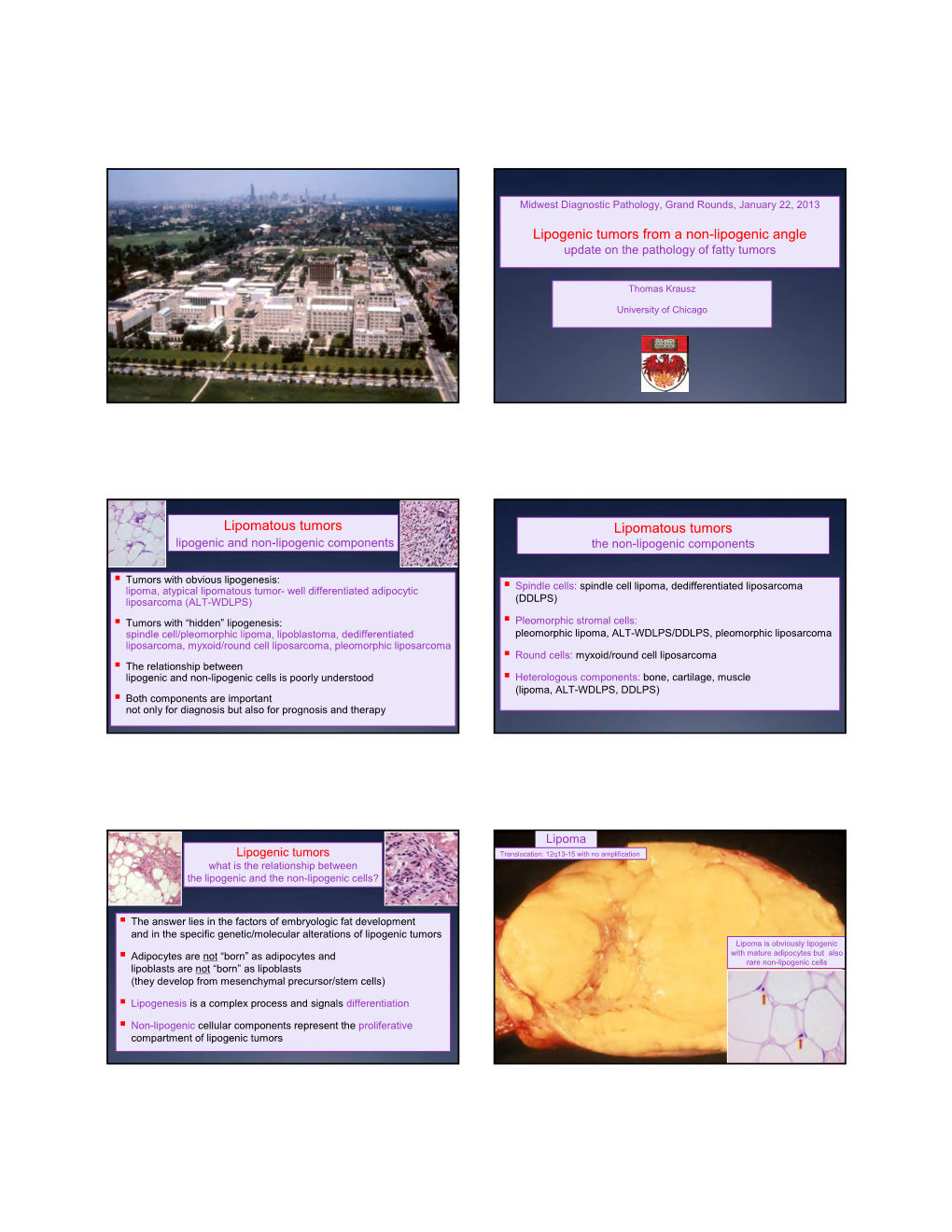 Lipogenic Tumors from a Non-Lipogenic Angle Lipomatous