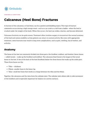 Calcaneus (Heel Bone) Fractures