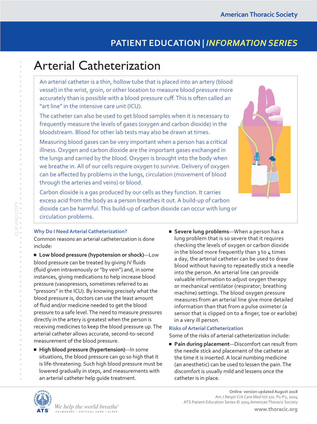 Arterial Catheterization