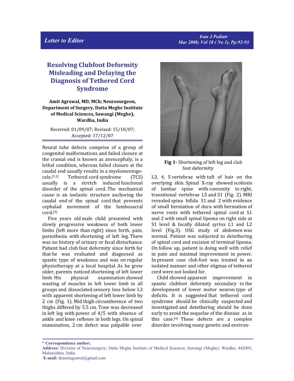 Resolving Clubfoot Deformity Misleading and Delaying the Diagnosis of Tethered Cord Syndrome