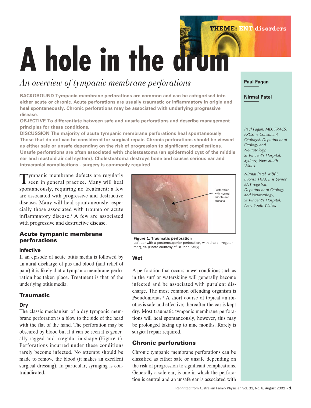 A Hole in the Drum an Overview of Tympanic Membrane Perforations Paul Fagan