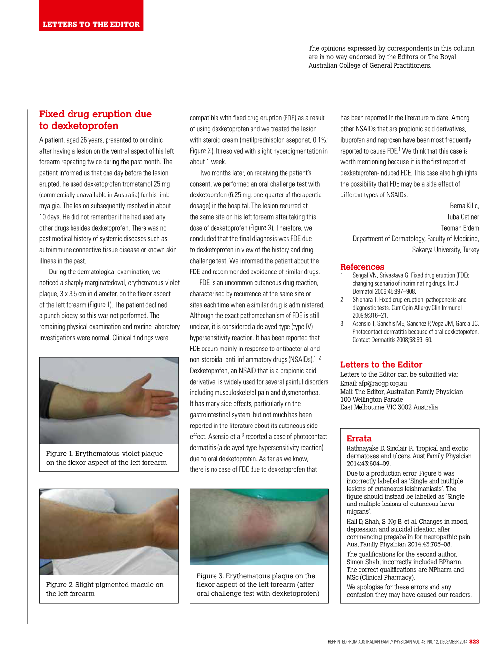 Fixed Drug Eruption Due to Dexketoprofen