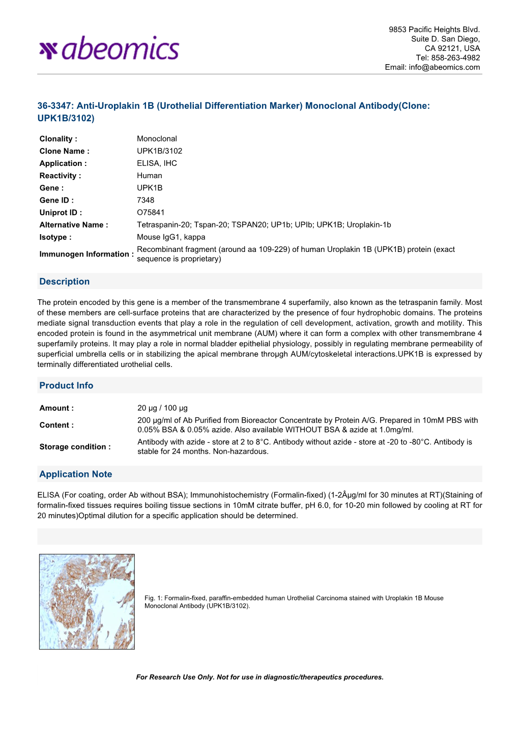 Monoclonal Antibody(Clone: UPK1B/3102)