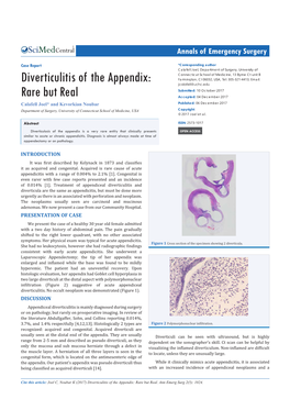 Diverticulitis of the Appendix: Farminqton, CI 06032, USA, Tel: 305-321-4413; Email