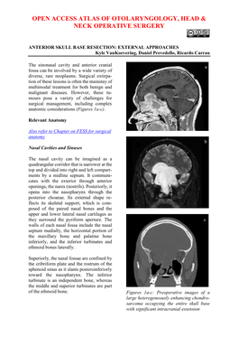 Anterior Skull Base Resection External Approaches