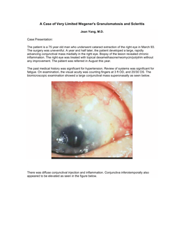 A Case of Very Limited Wegener's Granulomatosis and Scleritis