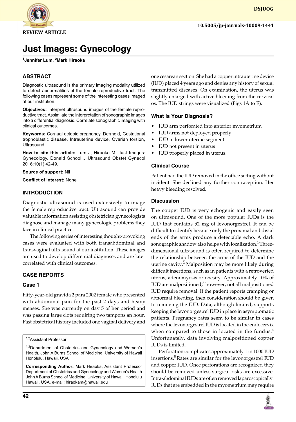 Donald School Journal of Ultrasound in Obstetrics and Gynecology, January-March 2016;10(1):42-49 43 Jennifer Lum, Mark Hiraoka