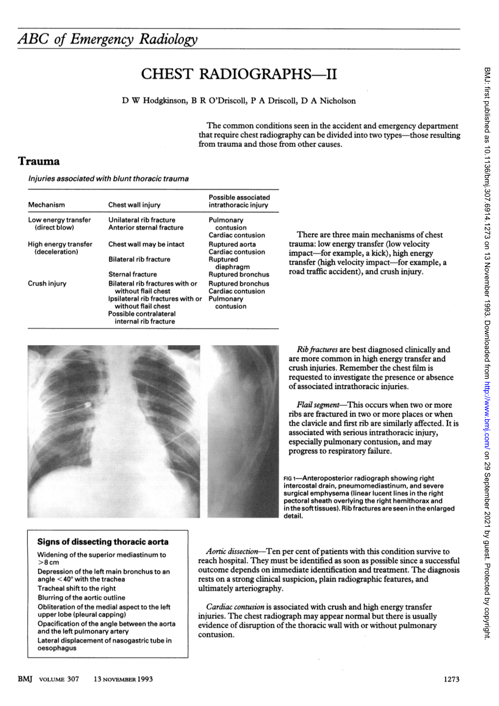 ABC of Emergency Radiology CHEST RADIOGRAPHS-II