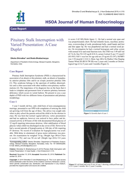 Pituitary Stalk Interruption with Varied Presentation: a Case Duplet