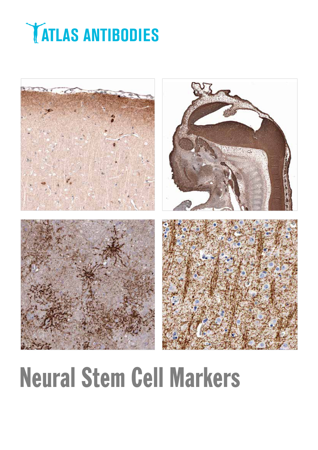 Neural Stem Cell Markers