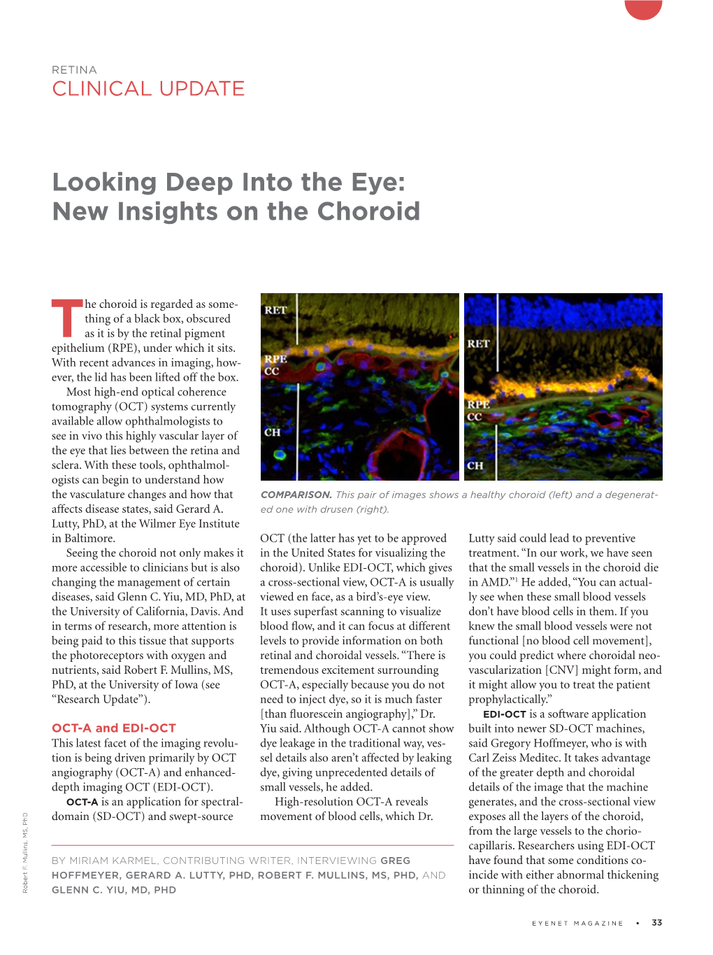 Looking Deep Into the Eye: New Insights on the Choroid