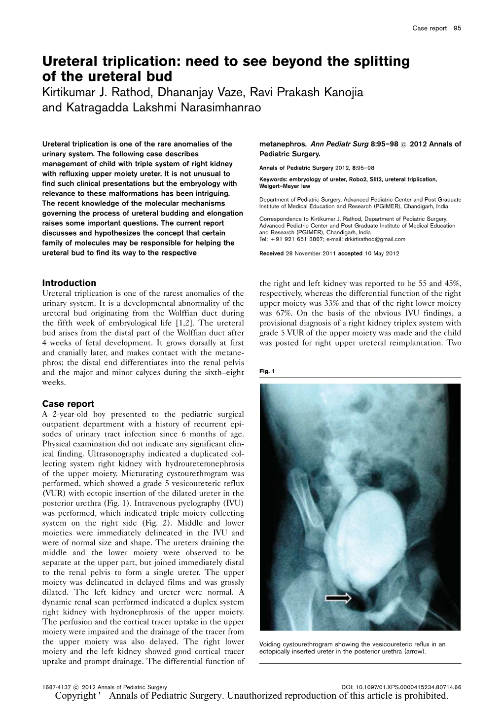 Ureteral Triplication: Need to See Beyond the Splitting of the Ureteral Bud Kirtikumar J