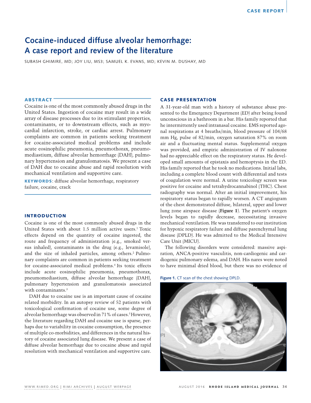 Cocaine-Induced Diffuse Alveolar Hemorrhage: a Case Report and Review of the Literature