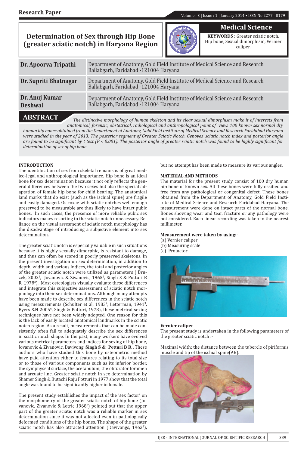 Medical Science Determination of Sex Through Hip Bone (Greater Sciatic